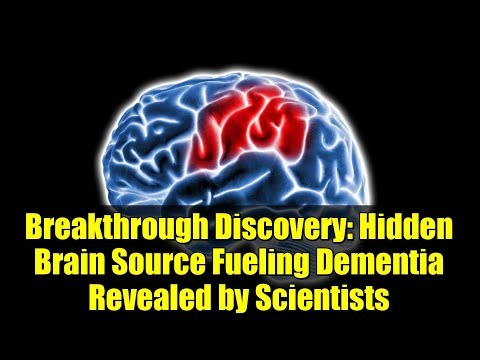 Breakthrough Discovery: Hidden Brain Source Fueling Dementia Revealed by Scientists