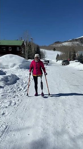 Talie, Hip Disarticulate Amputee