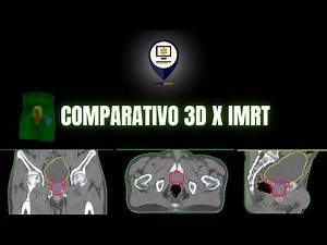 Aula 04 - Simulando um tratamento de próstata 3D x IMRT