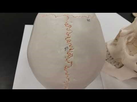 Basic Parietal Bone With bordering Sutures