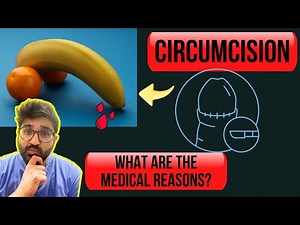 Doctor's Guide: Exploring Male Circumcision - Facts and Considerations