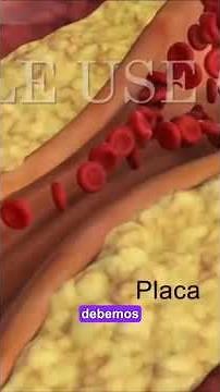 Saber de Salud: La angina inestable