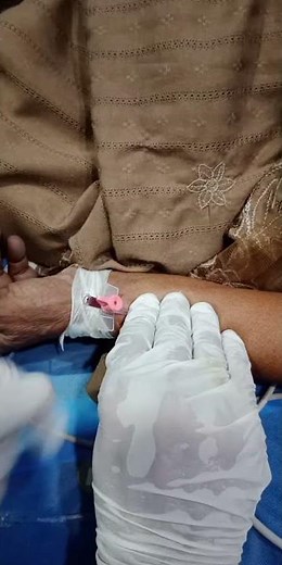 Arterial line procedure # critical care nursing # Icu procedure # nursing journey