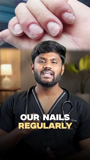 How to stop nail bitting?