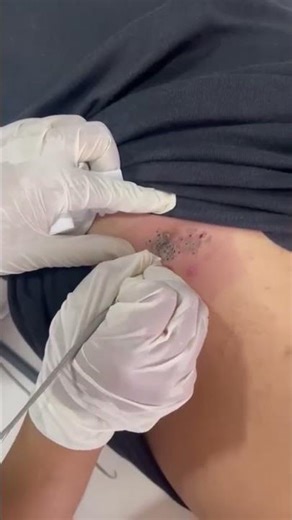 Comodone extraction 1