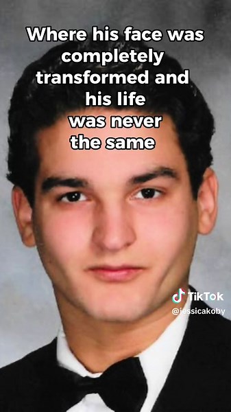 Joe Dimeo Car Accident: A Life-Altering Incident