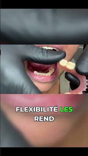 Retrouvez un sourire éclatant avec les prothèses flexibles #transformation #dentaire