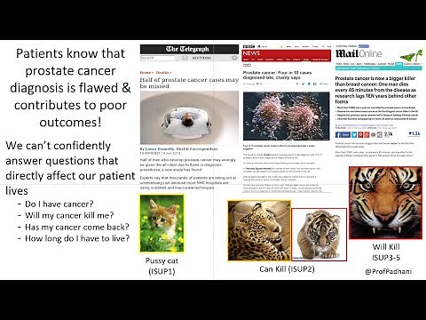 PI-RADS v2.1 for disease detection