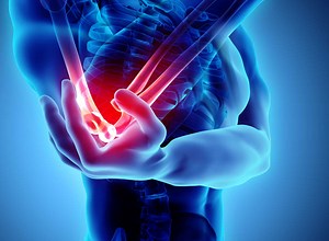 Workers’ Compensation Orthopedic Injury Care | CONA