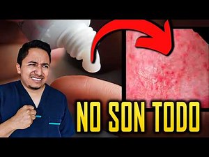 The Ultimate Guide to Removing Red Dots on the Glans