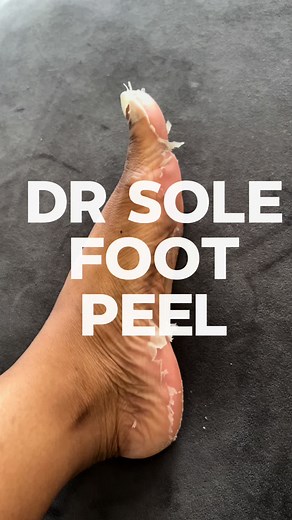 Discover an Effective Foot Peel for Renewed and Soft Feet