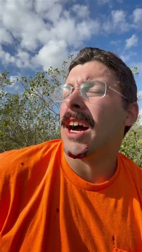 PYTHON BIT MY FACE!! 🤣🐍 #ytshorts #shorts #python #snakebite