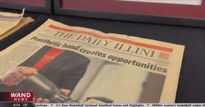 Bionic 'Ability Hand' gives amputees their touch back