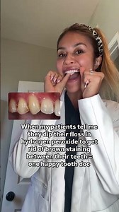 IMPORTANT to use no more than 3% hydrogen peroxide so you don’t cause damage to your teeth!