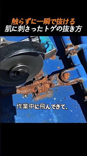 触らずに一瞬で抜ける肌に刺さったトゲの抜き方