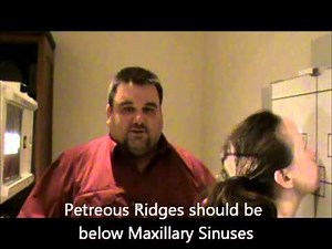 Sinuses