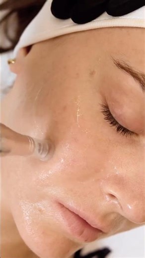 MEET THE SUPER ANTI-AGING FACIAL 🧬 #drbarbarasturm #skincare #ytshorts
