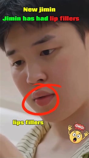 Jimin has had lip fillers 😱#the_korian_world #bts