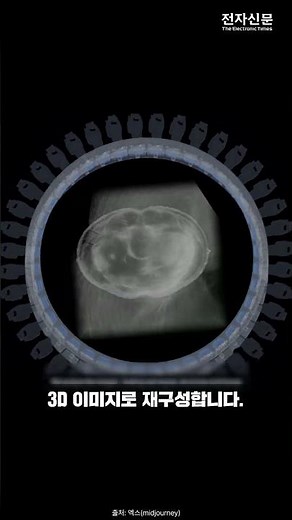 “Full-body scan in 60 seconds”… U.S. full-body ultrasound scanner unveiled