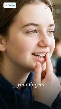 Just Got Your TADs? Here’s Everything You Need to Know | Orthodontist Explains