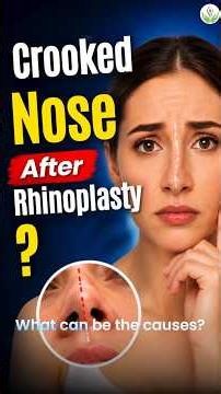 Why Does the Nose Become Crooked After Rhinoplasty? | Causes, Prevention & Recovery #crookednose