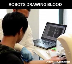 46K views · 638 reactions | Robots drawing blood | Anesthesia | Facebook