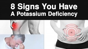 8 Signs You Have A Potassium Deficiency