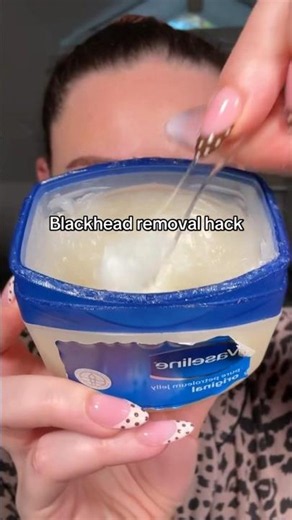 Vaseline to remove blackheads on nose👀 #skincare #blackheadsremoval #tipsandtricks #skincarehacks