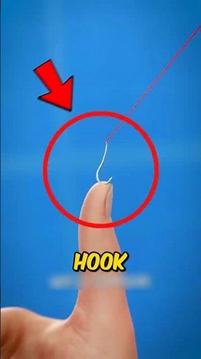👉 “Fish Hook Stuck in Your Skin? Do THIS Instead 😳”