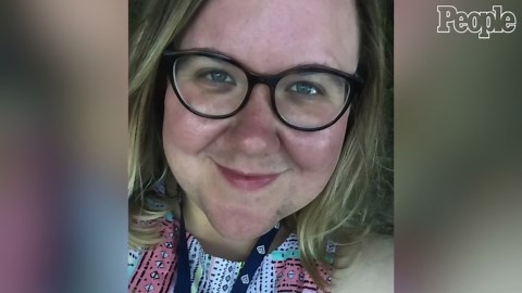 Woman with hormonal imbalance embraces her excess chest hair