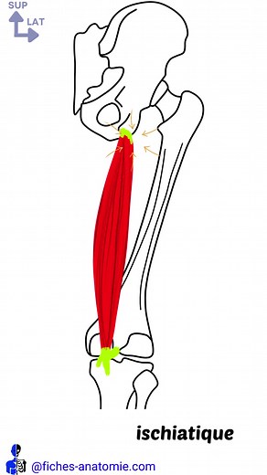 Fiche anatomie du muscle semi membraneux : 🦴 Origine : tubérosité ischiatique de l'os coxal 🦴Terminaison : - tendon direct : condyle tibial médial (face dorsal) - tendon réfléchi : condyle tibial médial (versant médial) - tendon récurrent : coque condylaire latérale ⚡Innervation : nerf sciatique 🩸 Vascularisation : artères fémorales et poplitées 💪 Action : extension de la cuisse, flexion de la jambe, rotation interne du tibia sur le fémur #anatomie #anatomy #medecine #paces #kine #osteo #sta