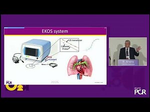 A simple low profile solution to the PE problem: EKOS™