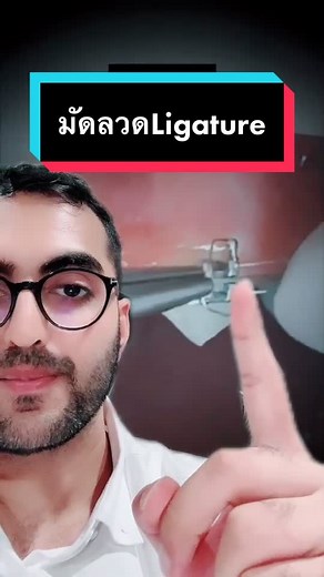 How to Put Back Ligatures: Step-by-Step Guide