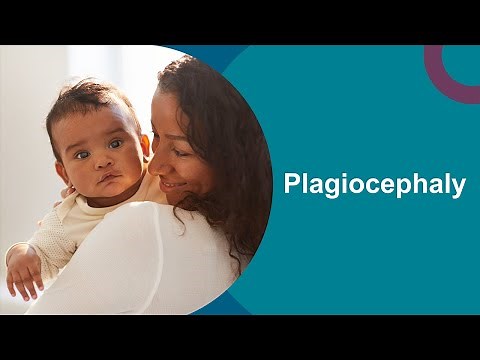 Plagiocephaly: Positioning for your baby