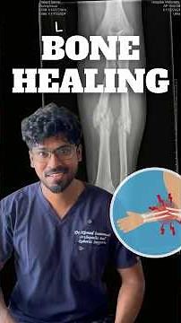Fracture Healing: The Only Repair Process in Body That Leaves No Trace - எலும்பு கூடும் ரகசியம்