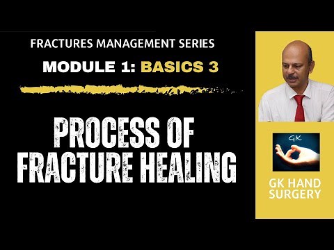 Hand fractures: Basics 3 - Processes of fracture healing - Direct and indirect healing phases.