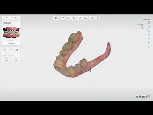 3Shape Implant Studio - Importação de escaneamentos, Preparação e o Anatomy Design