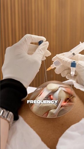 The truth about how knee radiofrequency ablation shuts down chronic joint pain live #PainManagement