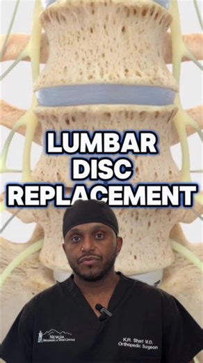 Lumbar disc replacement is all about motion preservation. For the right patient, it allows me to remove a painful, worn-out disc and replace it with an implant that maintains natural movement instead of locking the spine down. That means less stress on surrounding levels, better biomechanics, and the potential for a quicker, more natural recovery. It’s not for everyone—but when it’s the right option, lumbar disc replacement can be a game-changer for long-term spine health. #LumbarDiscReplacement