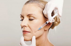 Mouth Wrinkles Botox & Filler (Carlisle) | Marionette & Smokers Lines | VL Aesthetics