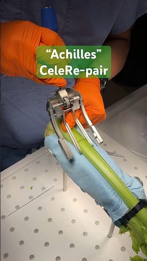 Achilles Midsubstance SpeedBridge. The celery was a great way to practice sutures #orthopedics