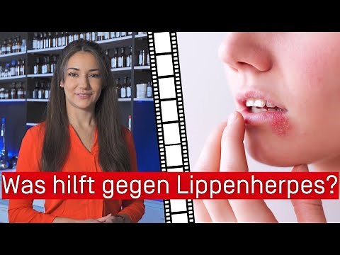 Was hilft gegen Lippenherpes?