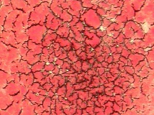 Live and dried Blood analysis - KATE DRIVER NATUROPATH