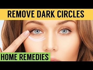 How to Get Rid of Dark Circles Naturally | Ramsha Sultan