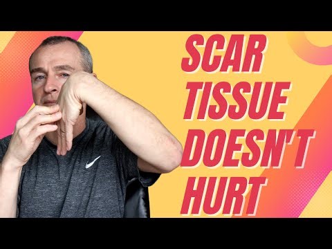 MUA - Total Knee Replacement