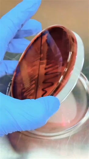 Prof. Dr. Alexandre Funck on Instagram: "🔬🧫🧪🦠 Escherichia coli on EMB and MacConkey Agar. . #microbiology #microbiologia #microbiología #microbiologie #mikrobiyoloji mikrobiologie bacteria virus fungo hongo fungus fungi laboratorio laboratory lab science biotecnologia biotechnology 🙌🏻 Credit: @specht_bio and col. ✅ Follow us: @euamomicrobiologia 🎯🎯🎯 Access our classes on YouTube: youtube.com/c/AlexandreFunck or click directly on our bio. ."