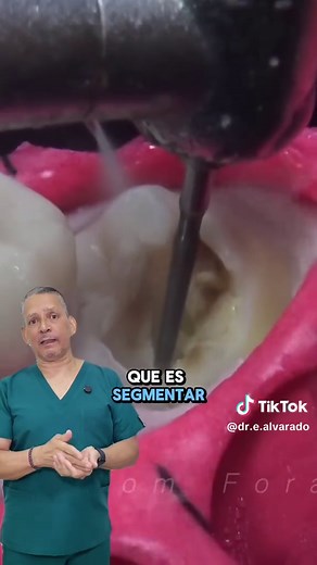 Extracción de tercer molar: Todo lo que necesitas saber