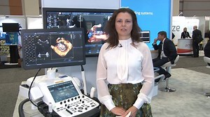 1.4K views · 41 reactions | VIDEO: GE Healthcare Cardiovascular...