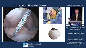 My Favorite Subscapularis Repair Tip