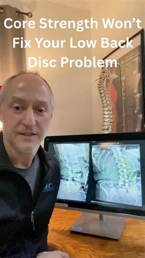Core Strength Won’t Fix Your Low Back Disc Problem